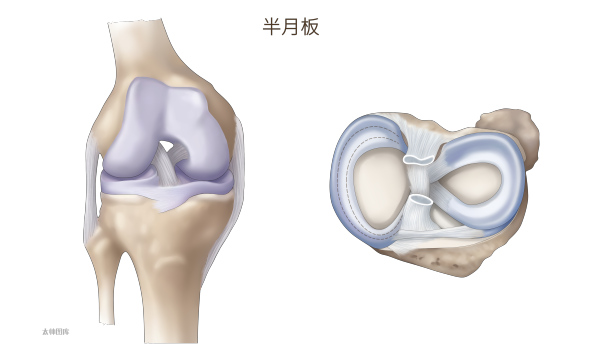 半月板撕裂 | 医学插画