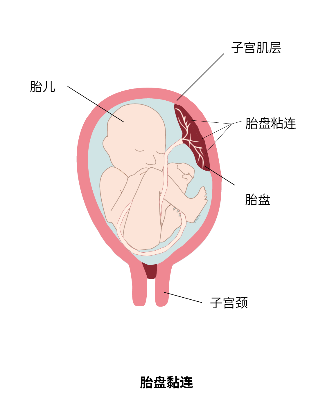胎盘图片宝宝图片